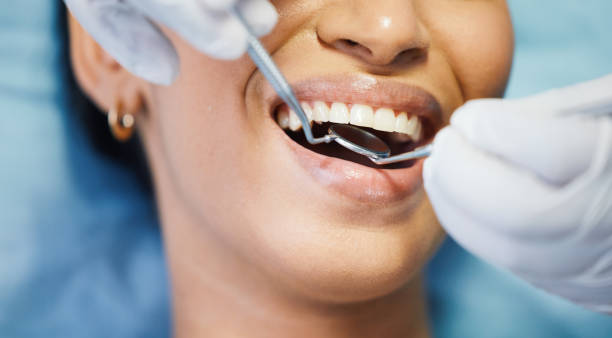 Best Cracked Tooth Emergency Dentist  in China Spring, TX